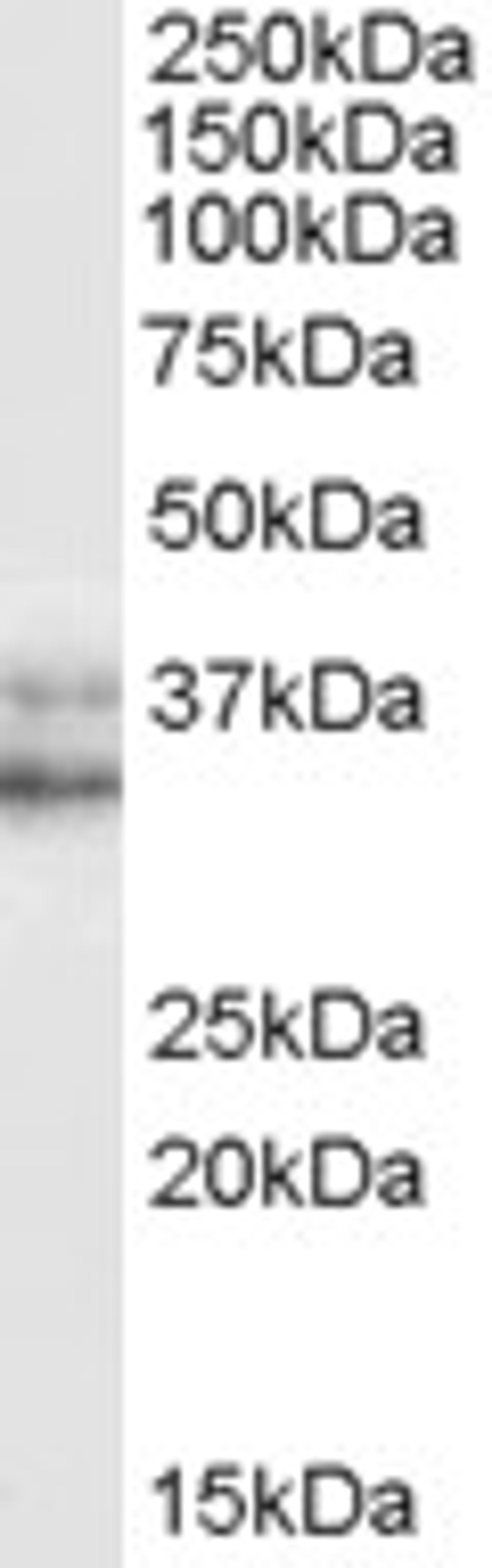 45-932 (0.05ug/ml) staining of HeLa (nuclear) cell lysate (35ug protein in RIPA buffer). Primary incubation was 1 hour. Detected by chemiluminescence.