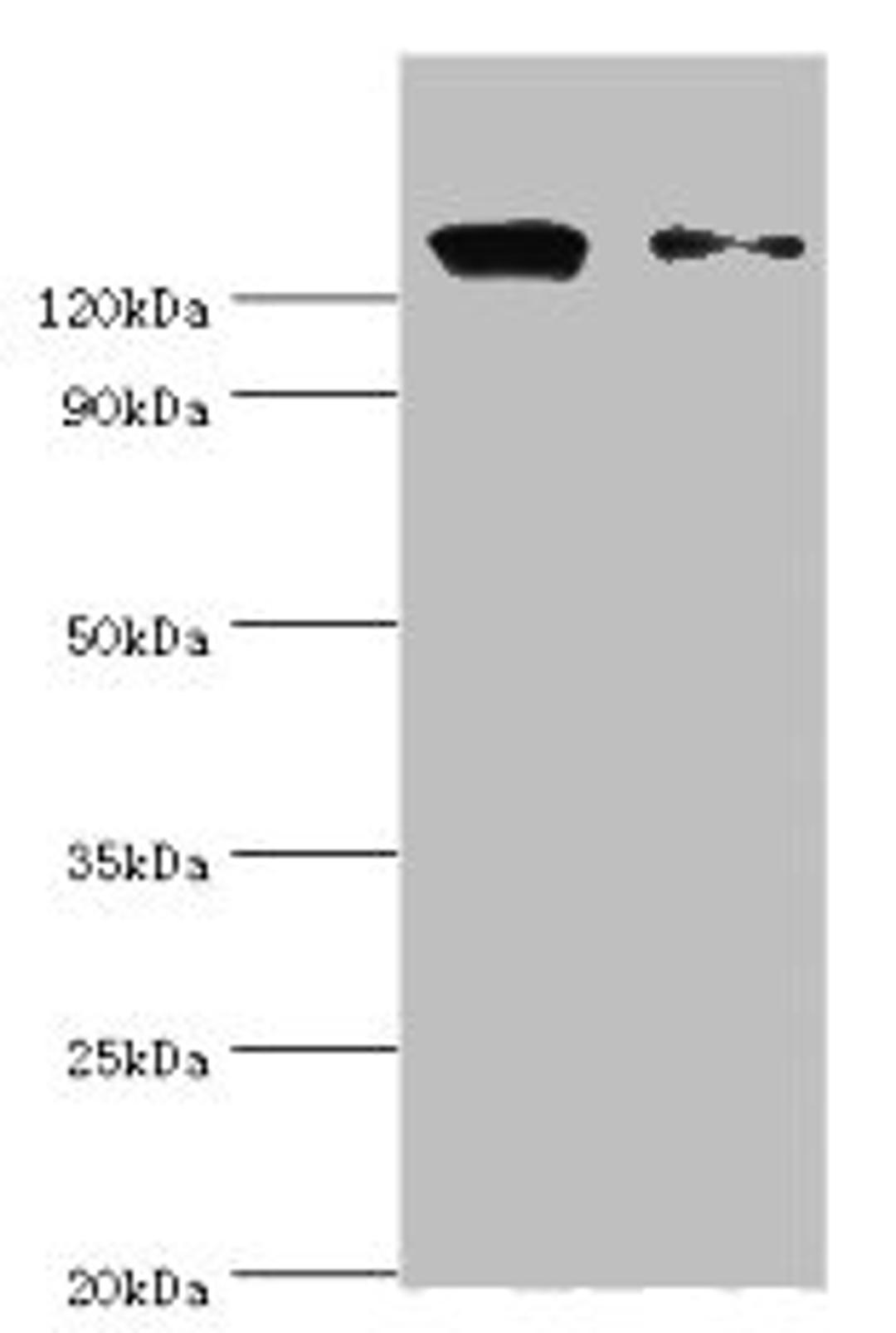 Western blot. All lanes: CCAR1 antibody at 10ug/ml. Lane 1: Hela whole cell lysate. Lane 2: PC-3 whole cell lysate. Secondary. Goat polyclonal to rabbit IgG at 1/10000 dilution. Predicted band size: 133, 132 kDa. Observed band size: 133 kDa. 