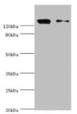 Western blot. All lanes: CCAR1 antibody at 10ug/ml. Lane 1: Hela whole cell lysate. Lane 2: PC-3 whole cell lysate. Secondary. Goat polyclonal to rabbit IgG at 1/10000 dilution. Predicted band size: 133, 132 kDa. Observed band size: 133 kDa. 