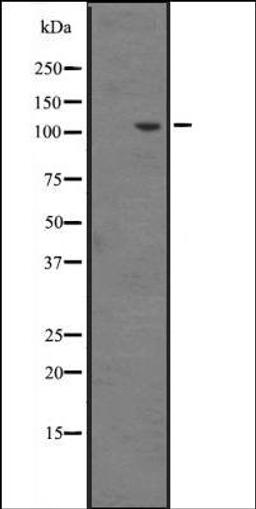 Western blot analysis of Hela cell lysate using INT6 antibody