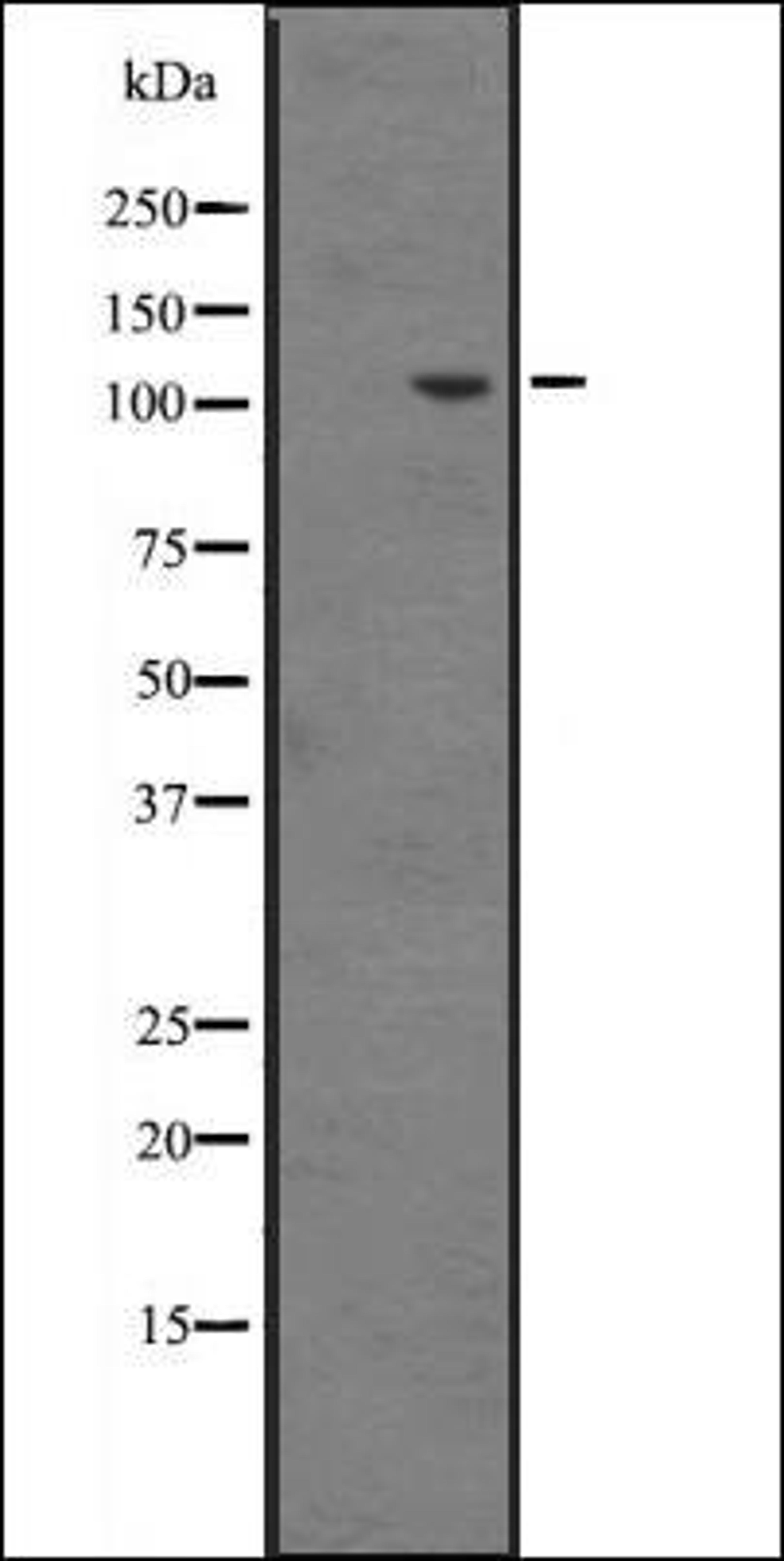 Western blot analysis of Hela cell lysate using INT6 antibody