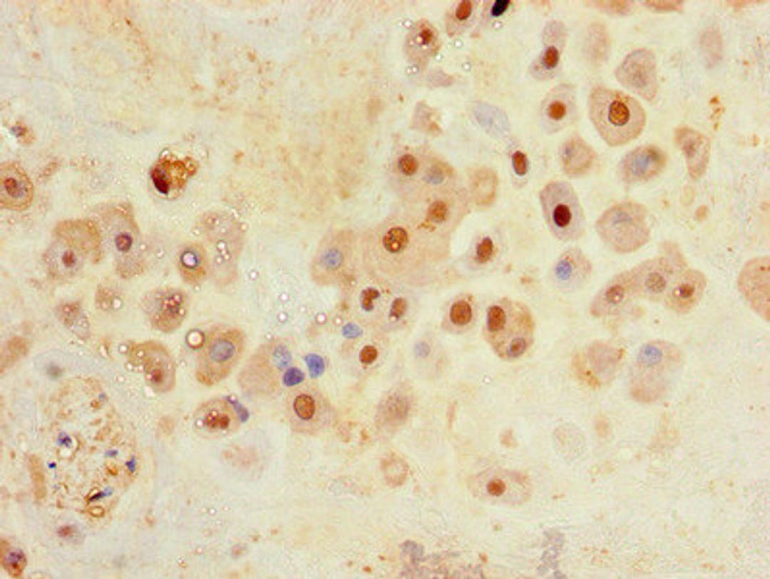 Immunohistochemistry of paraffin-embedded human placenta tissue using CSB-PA818247LA01HU at dilution of 1:100