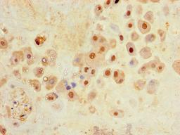 Immunohistochemistry of paraffin-embedded human placenta tissue using CSB-PA818247LA01HU at dilution of 1:100