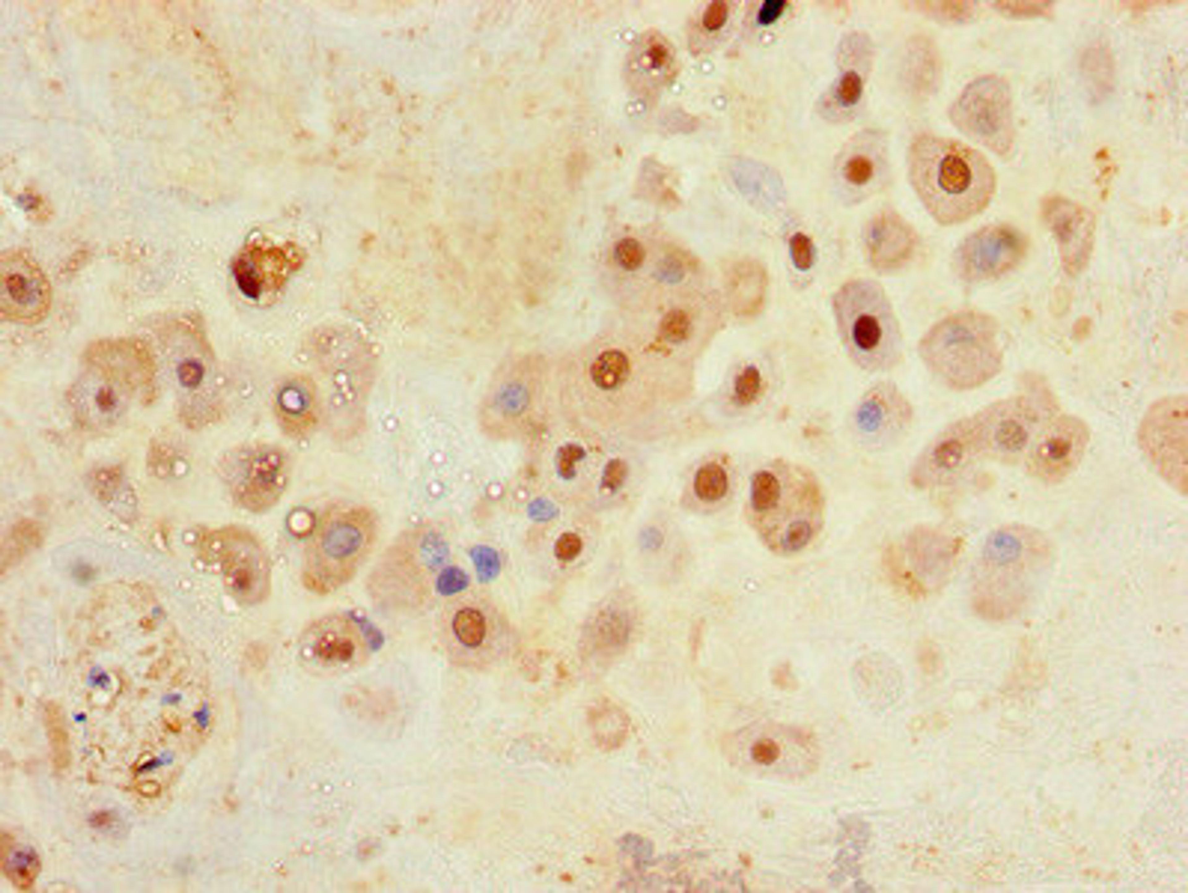 Immunohistochemistry of paraffin-embedded human placenta tissue using CSB-PA818247LA01HU at dilution of 1:100