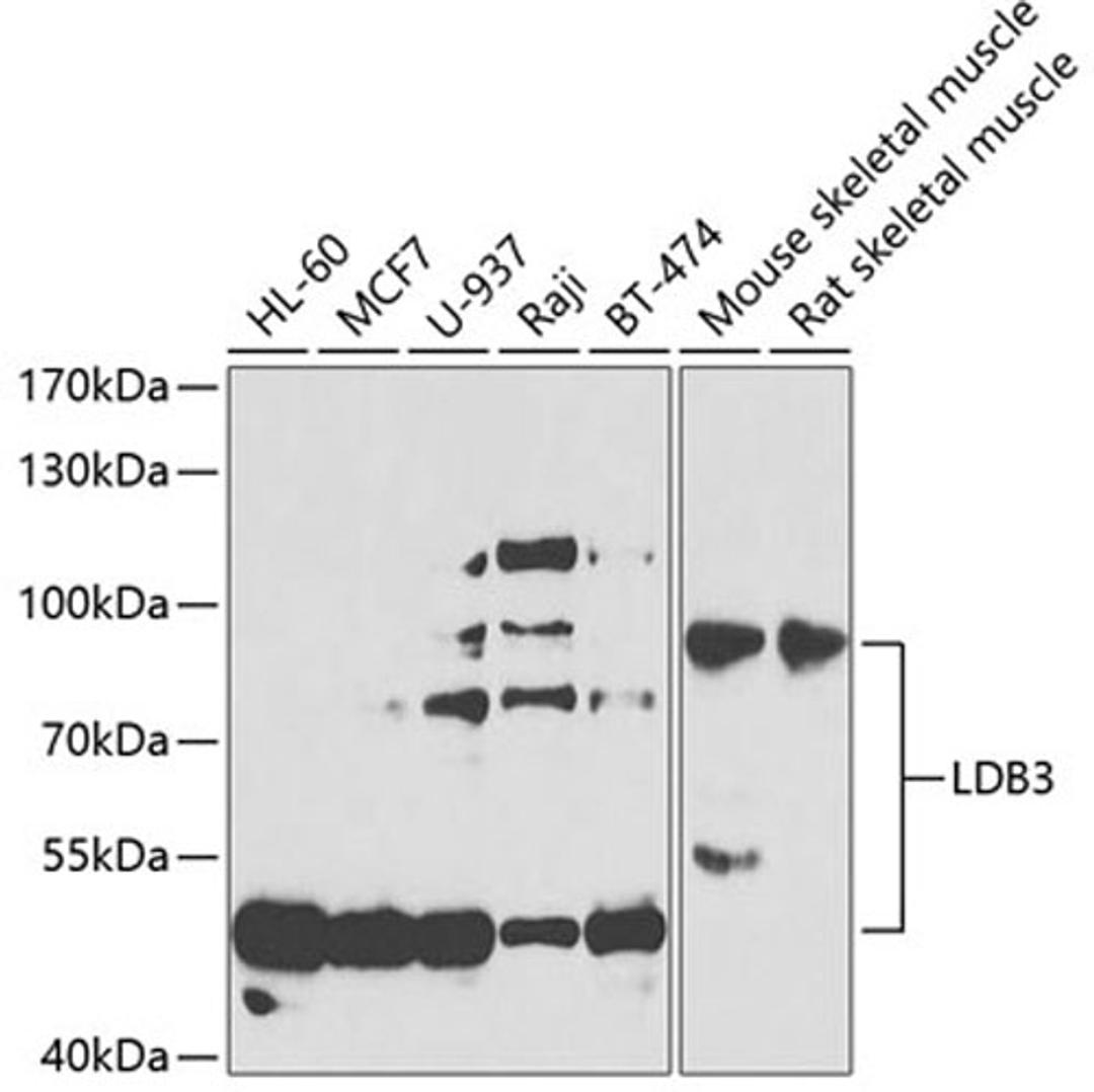 Western blot - LDB3 antibody (A7462)