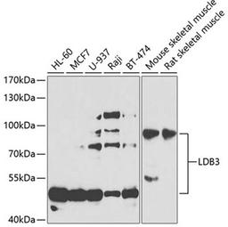 Western blot - LDB3 antibody (A7462)