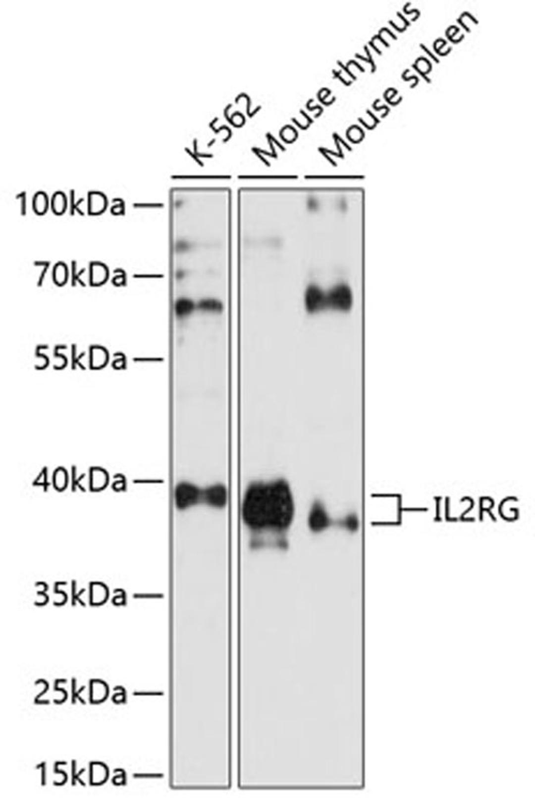 Western blot - IL2RG antibody (A1829)