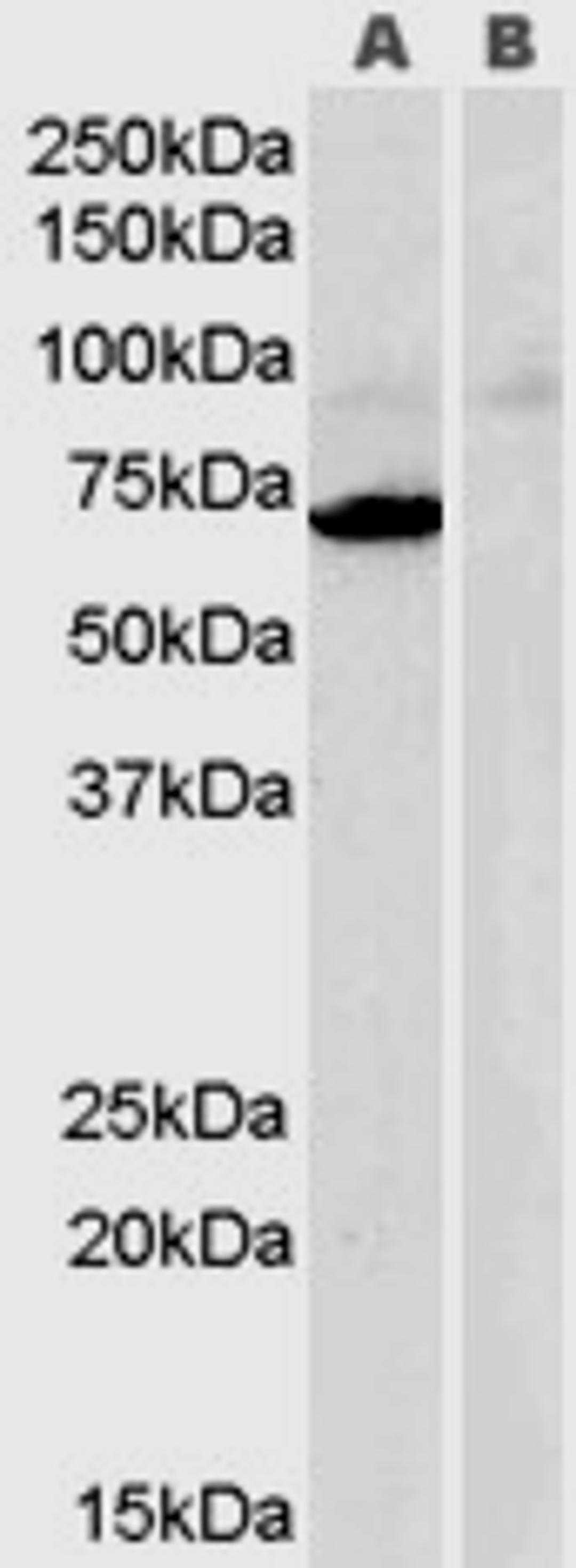 45-895 (0.3ug/ml) staining of Human Heart lysate (35ug protein in RIPA buffer) with (B) and without (A) blocking with the immunising peptide. Primary incubation was 1 hour. Detected by chemiluminescence.