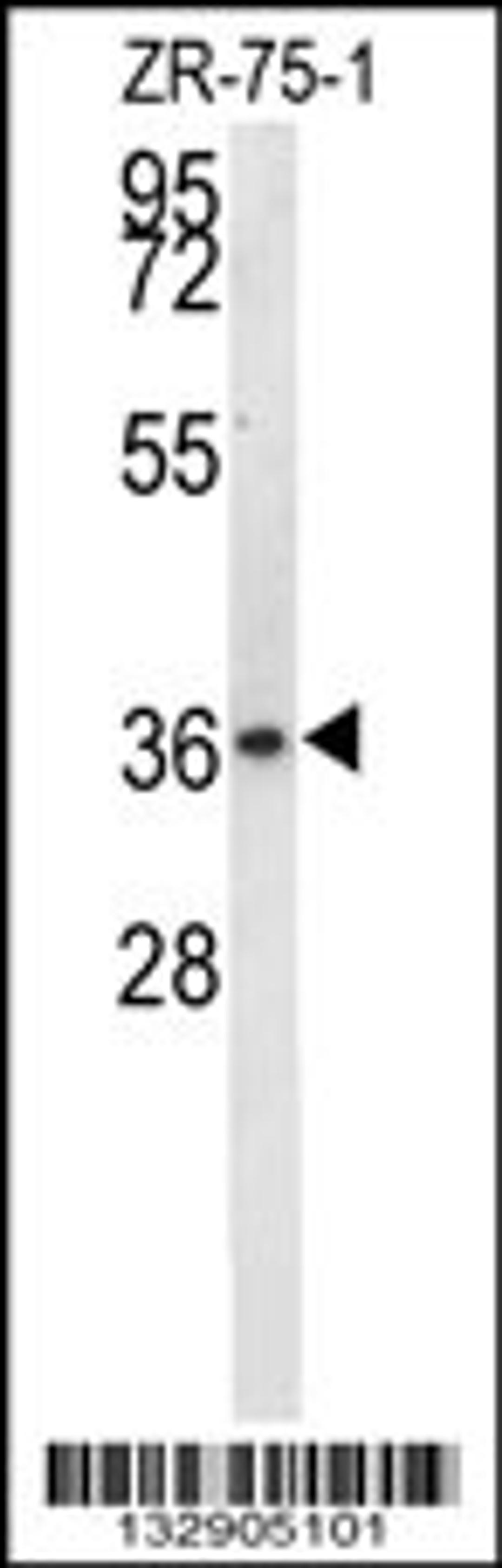 Western blot analysis in ZR-75-1 cell line lysates (35ug/lane).