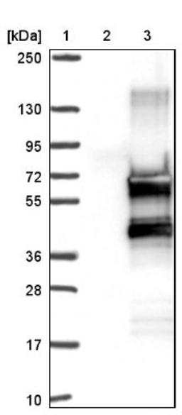 Western Blot: ZNF213 Antibody [NBP1-84386] - Lane 1: Marker [kDa] 250, 130, 95, 72, 55, 36, 28, 17, 10<br/>Lane 2: Negative control (vector only transfected HEK293T lysate)<br/>Lane 3: Over-expression lysate (Co-expressed with a C-terminal myc-DDK tag (~3.1 kDa) in mammalian HEK293T cells, LY418147)