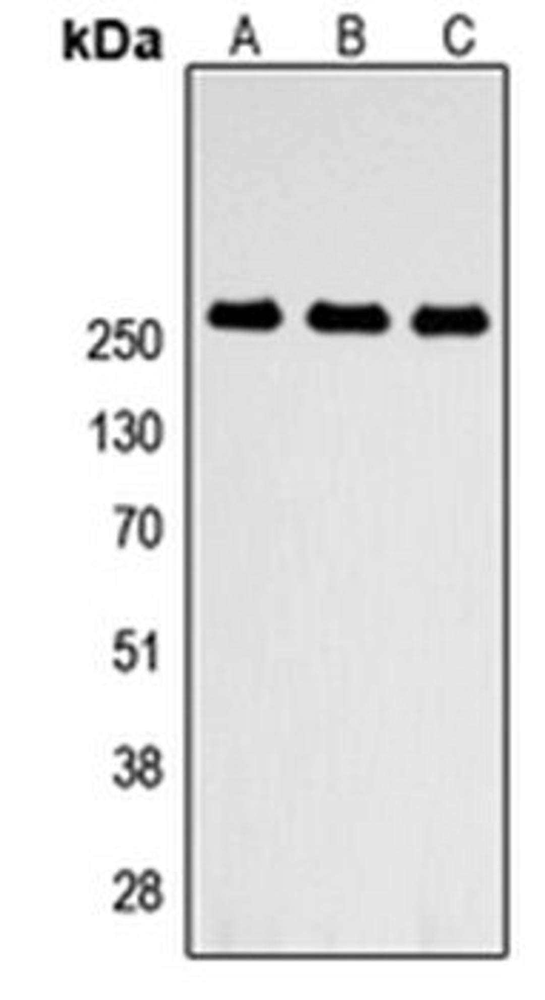 Western blot analysis of HEK293T (Lane 1), NS-1 (Lane 2), PC12 (Lane 3) whole cell lysates using ABCA4 antibody