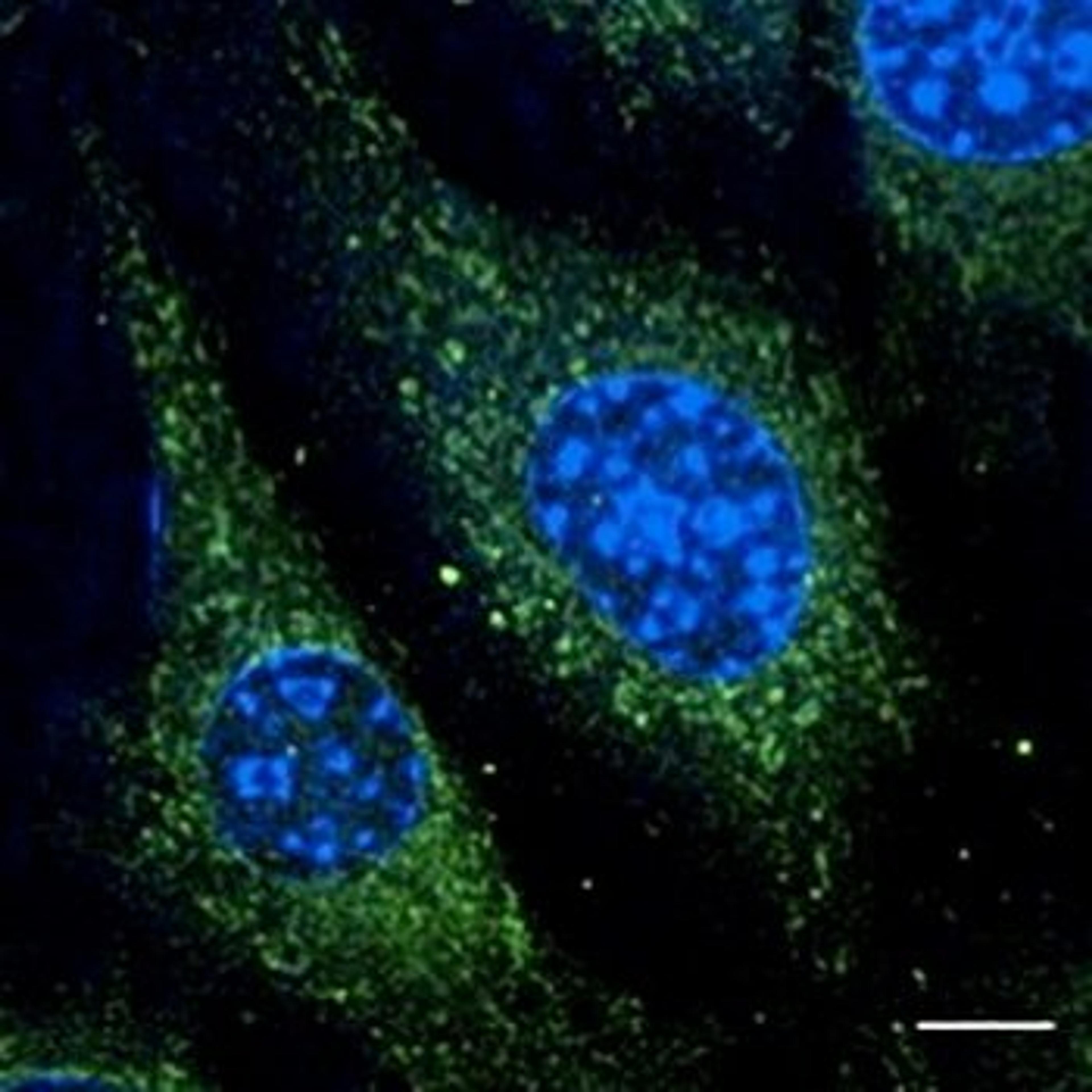 Confocal immunofluoroscence analysis of B6-RPE07 cells using Rab5 antibody.