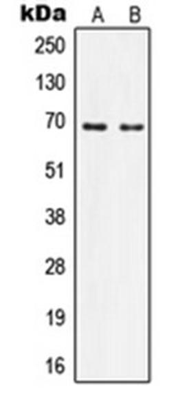 Western blot analysis of Ramos (Lane 1), HeLa (Lane 2) whole cell lysates using IQCB1 antibody