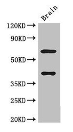 Western Blot. Positive WB detected in: Mouse brain tissue. All lanes: LRRTM4 antibody at 3µg/ml. Secondary. Goat polyclonal to rabbit IgG at 1/50000 dilution. Predicted band size: 68, 60 kDa. Observed band size: 68, 40 kDa