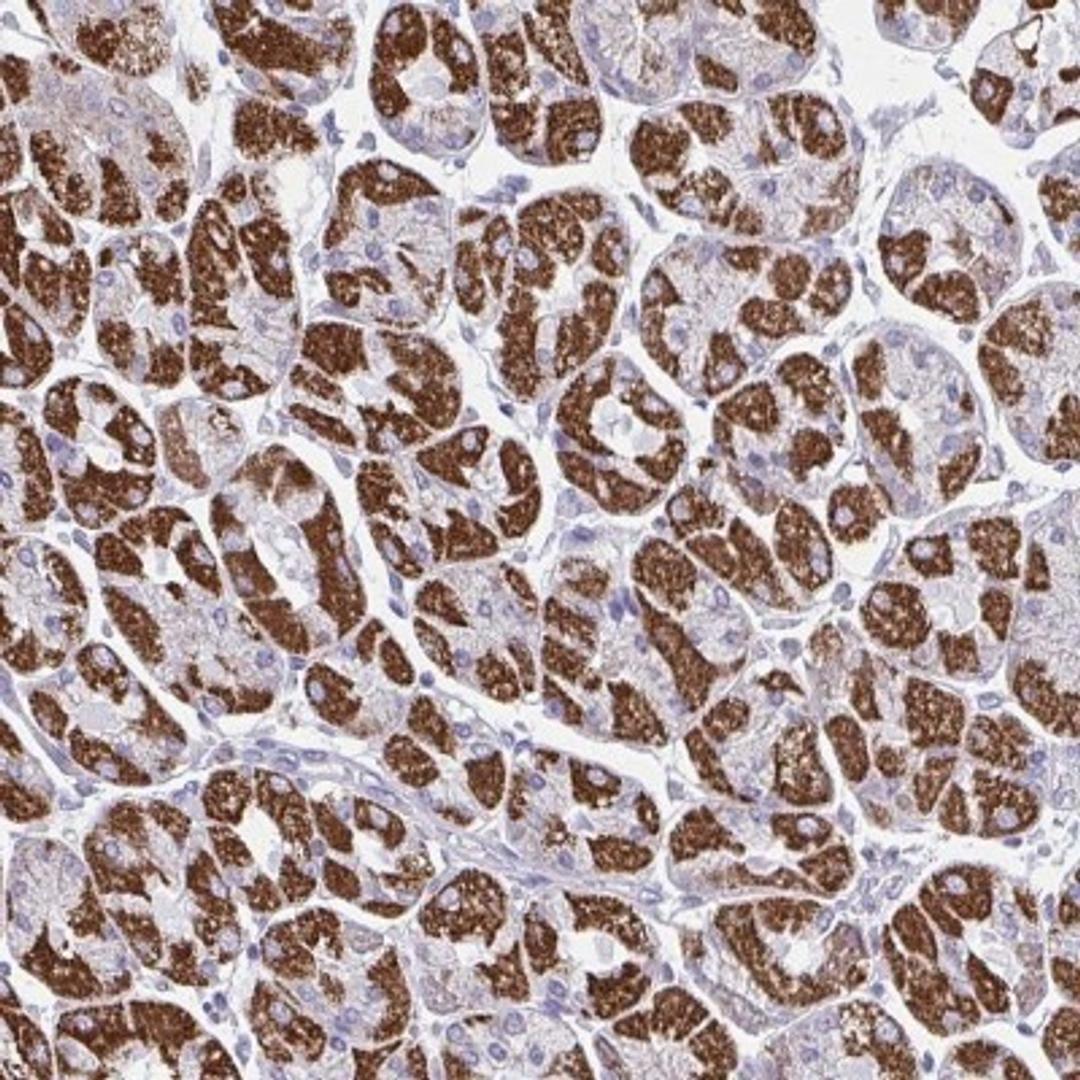 Immunohistochemistry: OR13A1 Antibody [NBP2-31665] - Staining of human stomach, upper shows strong cytoplasmic positivity in glandular cells.