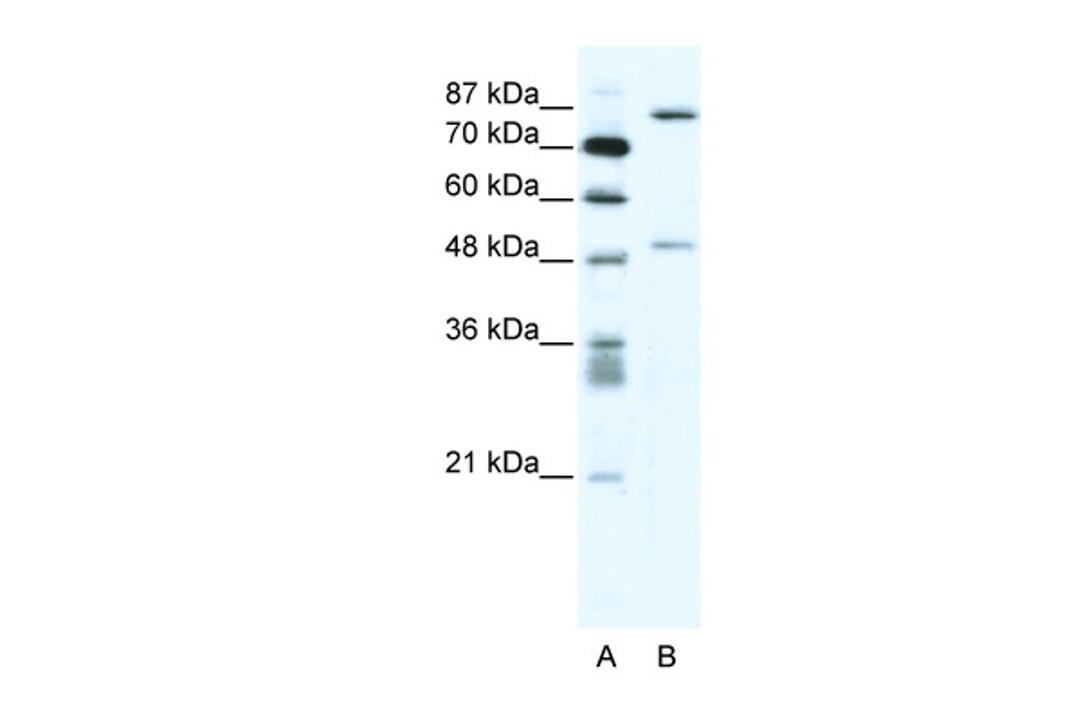 Antibody used in WB on Human Jurkat 2.5 ug/ml.