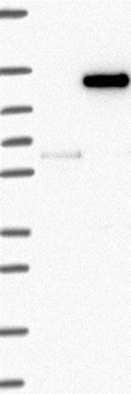 Western Blot: WDR63 Antibody [NBP2-32639] - Lane 1: Marker [kDa] 250, 130, 95, 72, 55, 36, 28, 17, 10 | Lane 2: Negative control (vector only transfected HEK293T lysate) | Lane 3: Over-expression Lysate (Co-expressed with a C-terminal myc-DDK tag (~3.1 kDa) in mammalian HEK293T cells, <a href="http