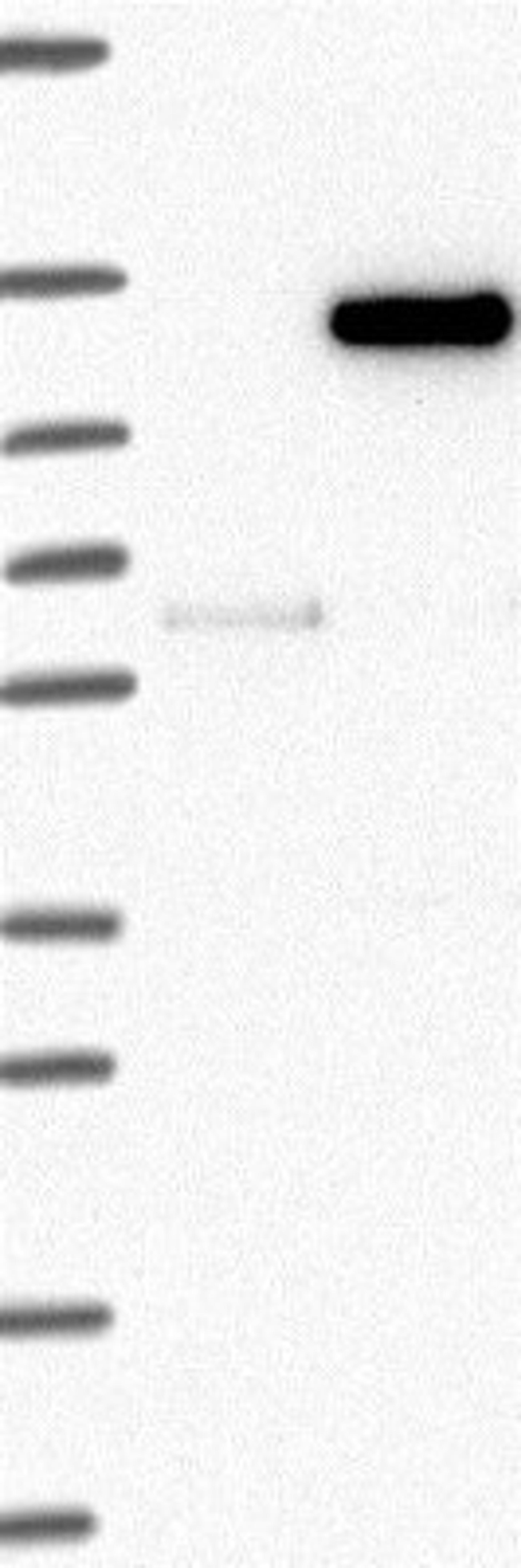 Western Blot: WDR63 Antibody [NBP2-32639] - Lane 1: Marker [kDa] 250, 130, 95, 72, 55, 36, 28, 17, 10 | Lane 2: Negative control (vector only transfected HEK293T lysate) | Lane 3: Over-expression Lysate (Co-expressed with a C-terminal myc-DDK tag (~3.1 kDa) in mammalian HEK293T cells, <a href="http