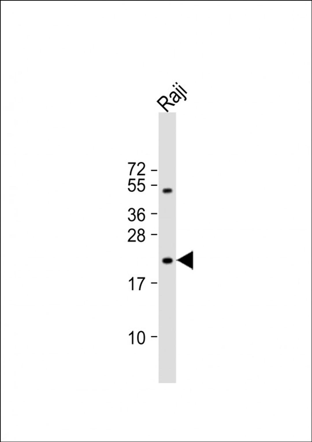 Western Blot at 1:1000 dilution + Raji whole cell lysate Lysates/proteins at 20 ug per lane.