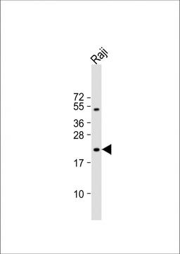 Western Blot at 1:1000 dilution + Raji whole cell lysate Lysates/proteins at 20 ug per lane.