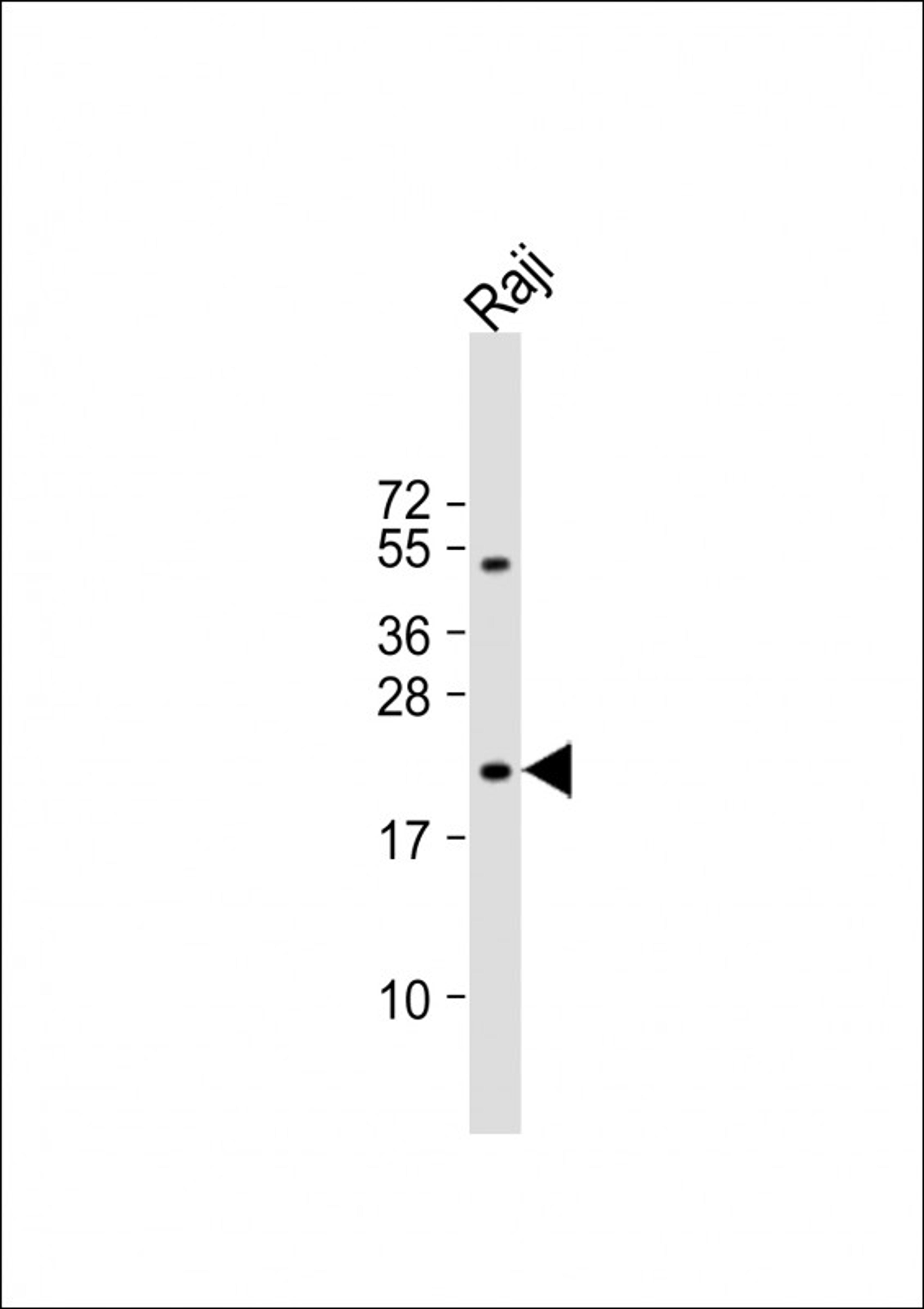 Western Blot at 1:1000 dilution + Raji whole cell lysate Lysates/proteins at 20 ug per lane.