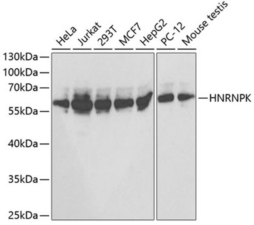 Western blot - HNRNPK antibody (A1701)