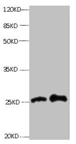 All lanes: Mouse anti- human Retinol-binding protein 4 monoclonal antibody at 0.3ug/ml. Lane 1: Human positive serum1:10. Lane 2: Human positive serum1:100. Secondary:HRP labeled Goat polyclonal to Mouse IgG at 1/3000 dilution. Predicted band size : 23kd. Observed band size : 27kd.