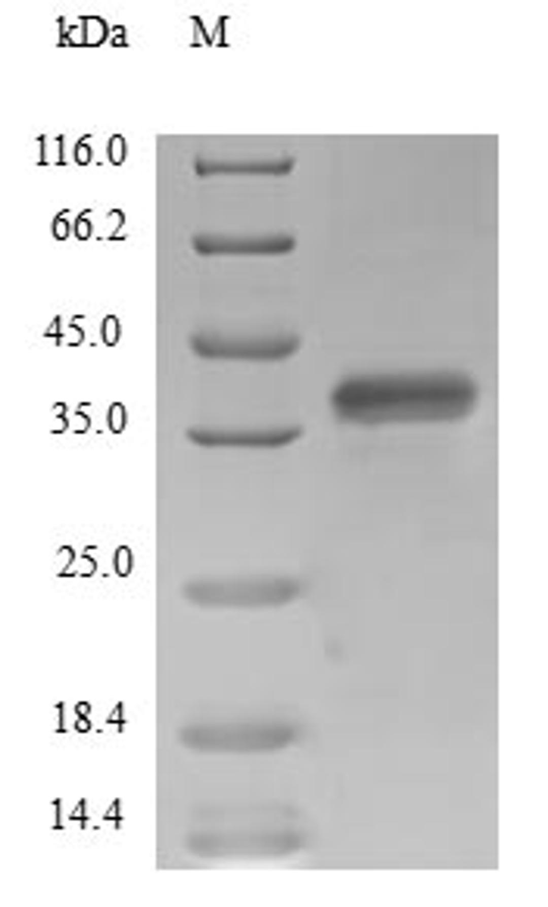 (Tris-Glycine gel) Discontinuous SDS-PAGE (reduced) with 5% enrichment gel and 15% separation gel.