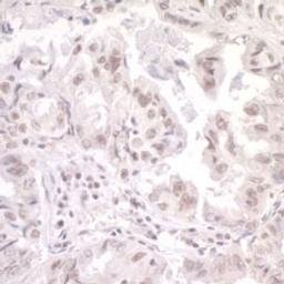 Detection of human SKIV2L2 by immunohistochemistry.