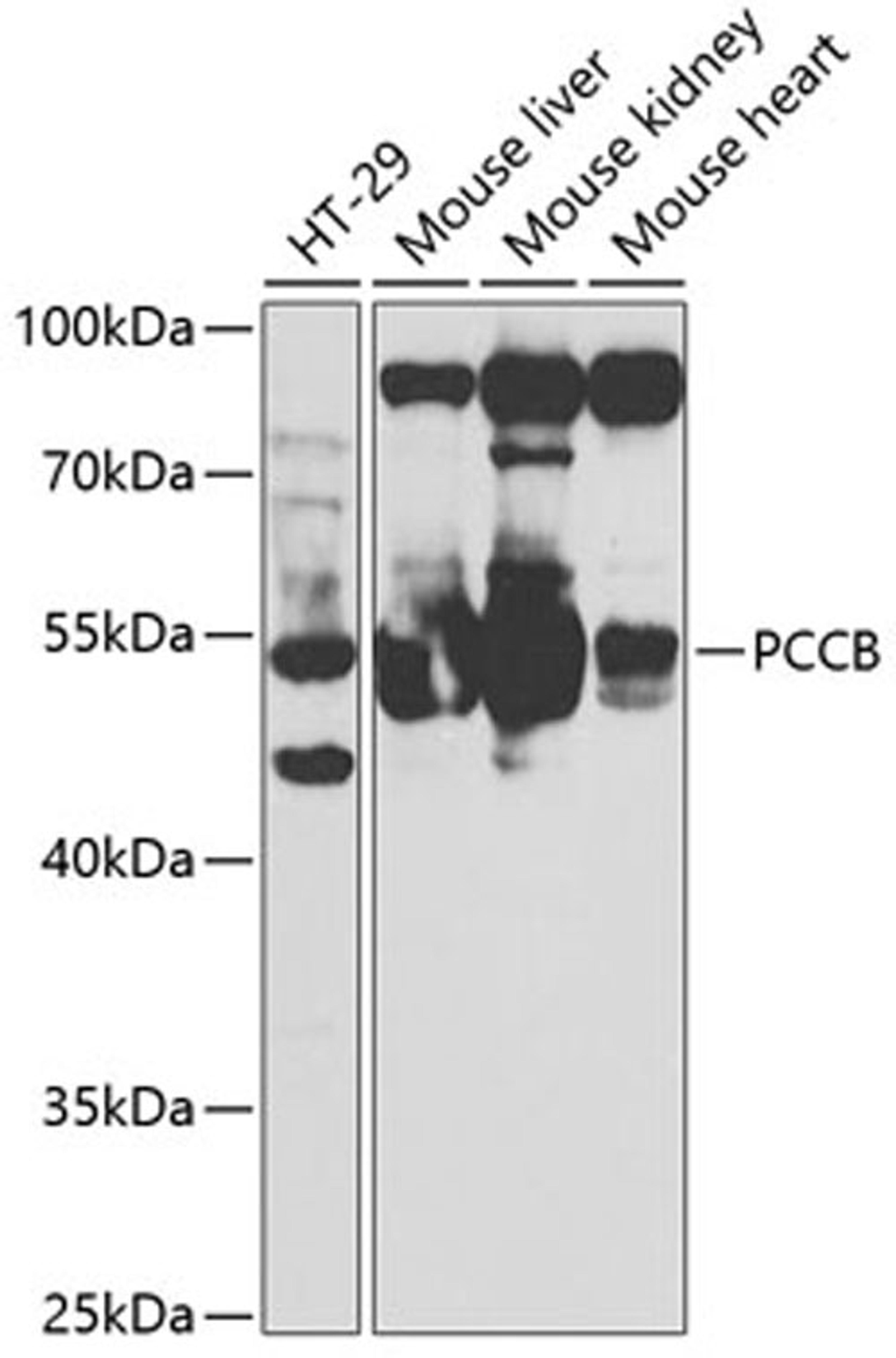 Western blot - PCCB antibody (A5415)