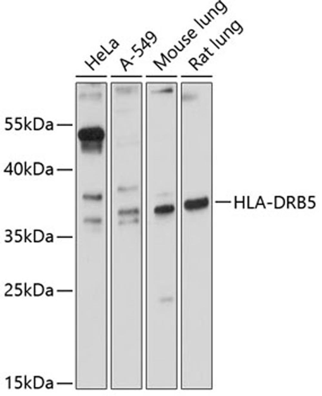 Western blot - HLA-DRB5 antibody (A12726)