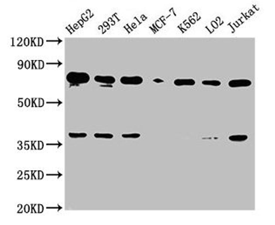 Western Blot. Positive WB detected in: HepG2 whole cell lysate, 293T whole cell lysate, Hela whole cell lysate, MCF-7 whole cell lysate, K562 whole cell lysate, LO2 whole cell lysate, Jurkat whole cell lysate. All lanes: UBC antibody at 1:2000. Secondary. Goat polyclonal to rabbit IgG at 1/50000 dilution. Predicted band size: 78 kDa. Observed band size: 78 kDa