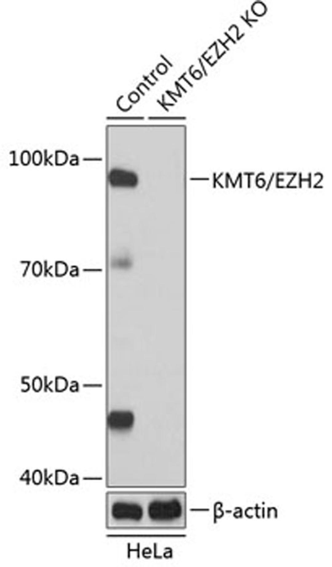 Western blot - KMT6 / EZH2 antibody (A19577)