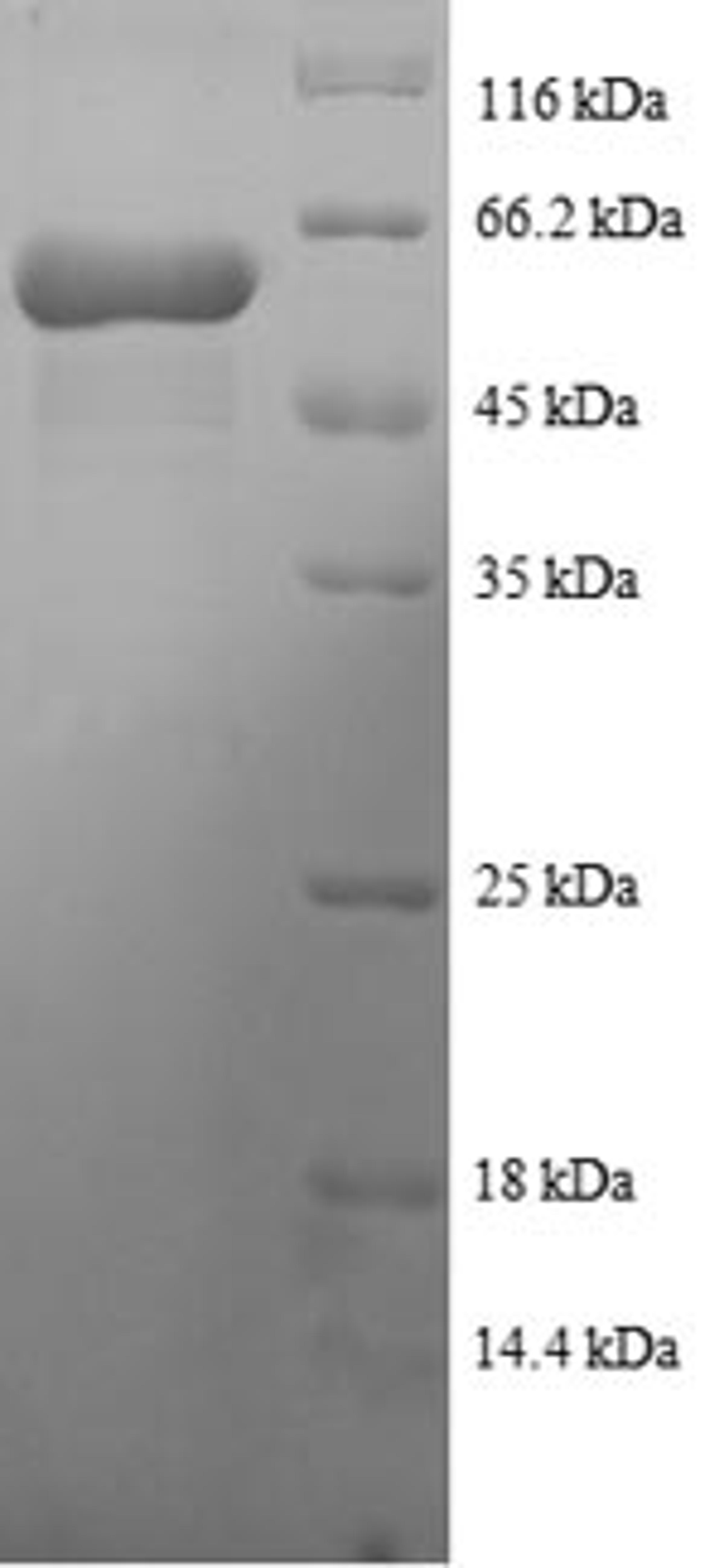 (Tris-Glycine gel) Discontinuous SDS-PAGE (reduced) with 5% enrichment gel and 15% separation gel.