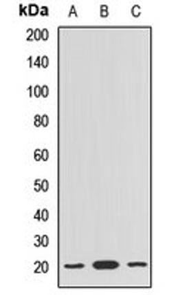 Western blot analysis of HepG2 (Lane1), K562 (Lane2), rat testis (Lane3) whole cell lysates using BLOC1S6 antibody