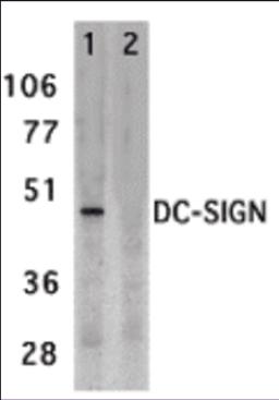 Western blot analysis of DC-SIGN expression in human placenta tissue lysate in the absence (lane 1) and presence (lane 2) of blocking peptide with DC-SIGN antibody at 2 &#956;g /ml. 