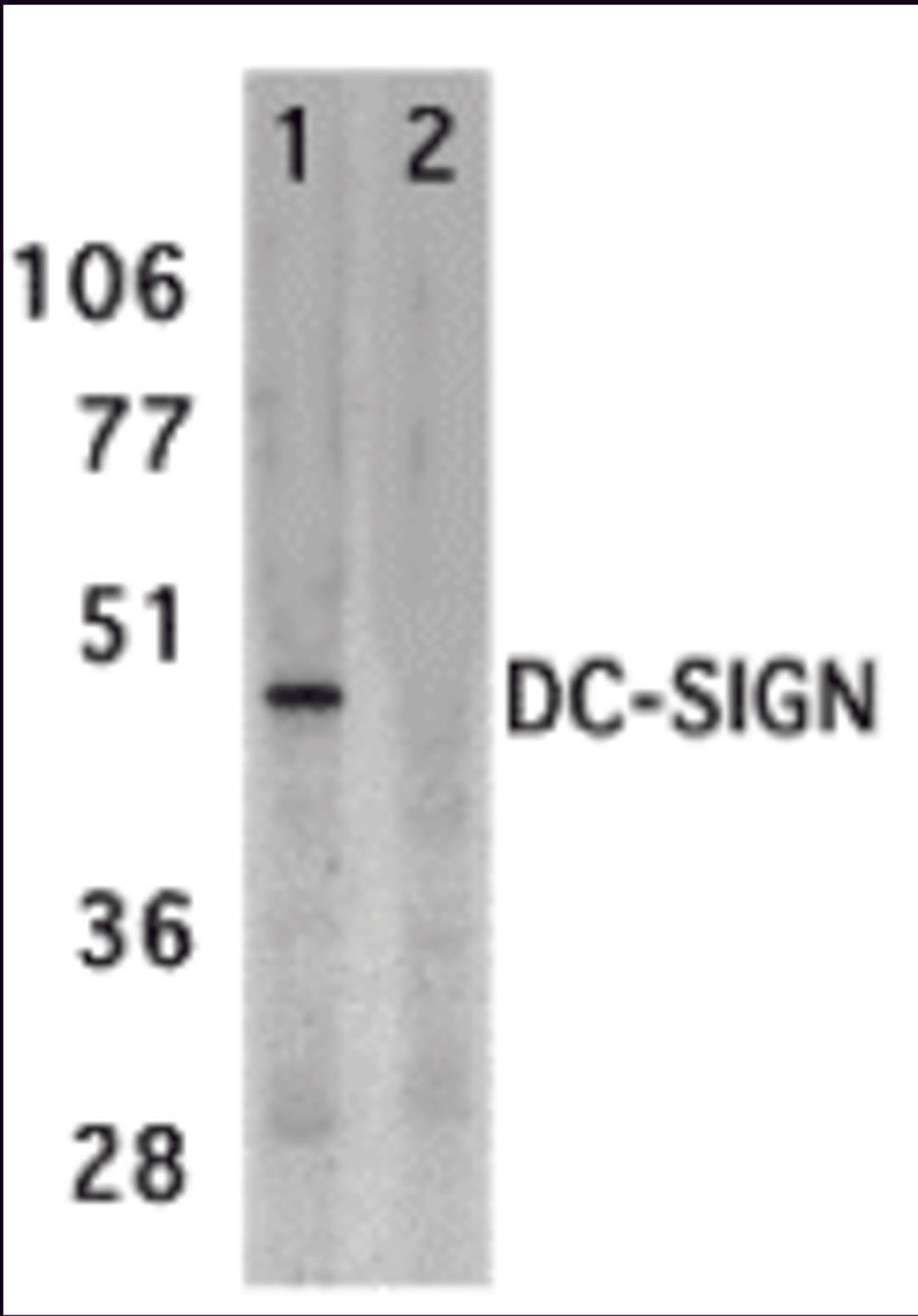 Western blot analysis of DC-SIGN expression in human placenta tissue lysate in the absence (lane 1) and presence (lane 2) of blocking peptide with DC-SIGN antibody at 2 μg /ml.