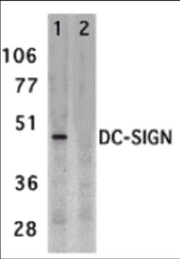 Western blot analysis of DC-SIGN expression in human placenta tissue lysate in the absence (lane 1) and presence (lane 2) of blocking peptide with DC-SIGN antibody at 2 μg /ml.