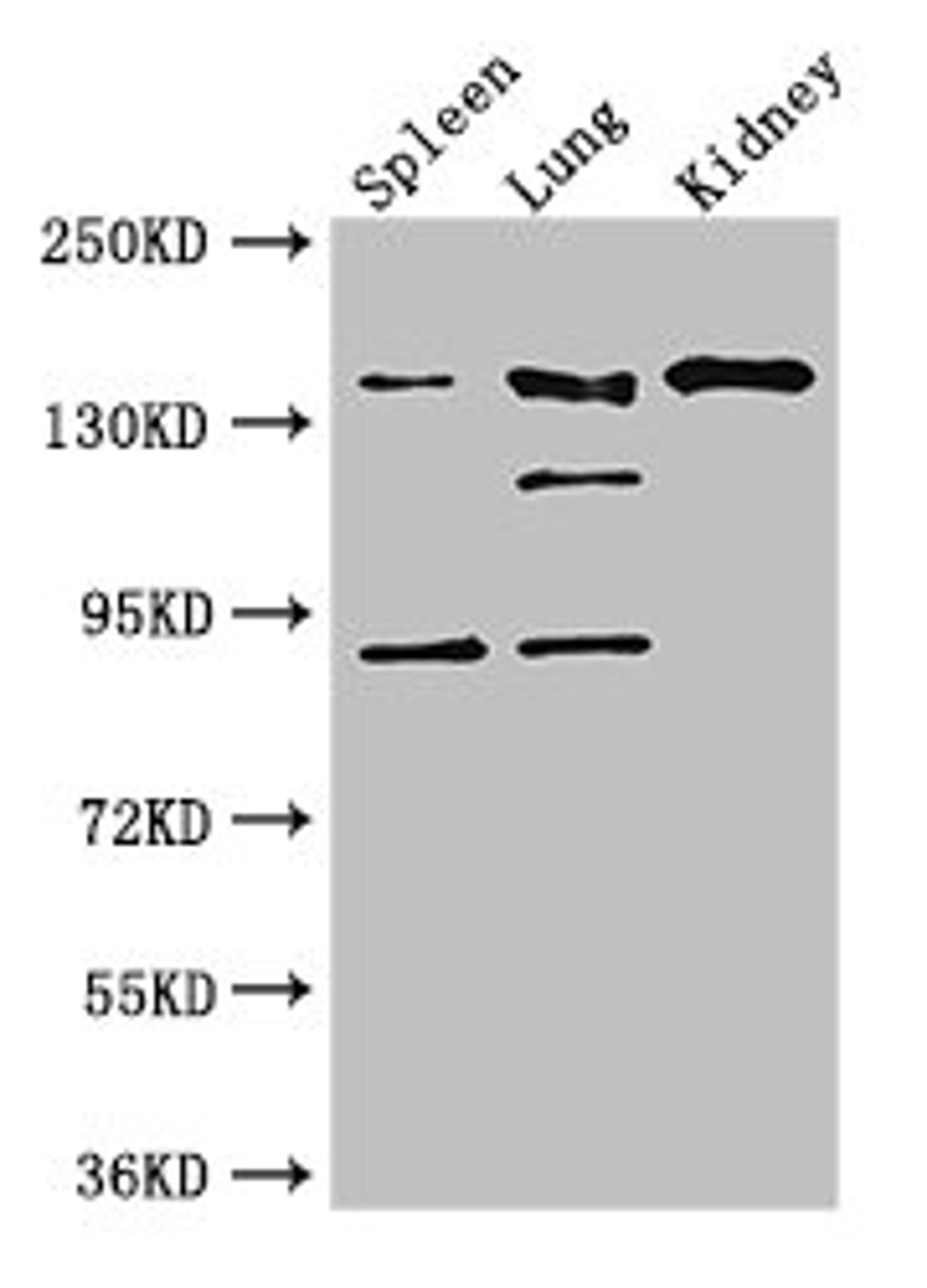 Western Blot. Positive WB detected in: Mouse spleen tissue, Mouse lung tissue, Mouse kidney tissue. All lanes: NOS1 antibody at 3ug/ml. Secondary. Goat polyclonal to rabbit IgG at 1/50000 dilution. Predicted band size: 161, 149, 126, 44, 165 kDa. Observed band size: 161, 126, 92 kDa.