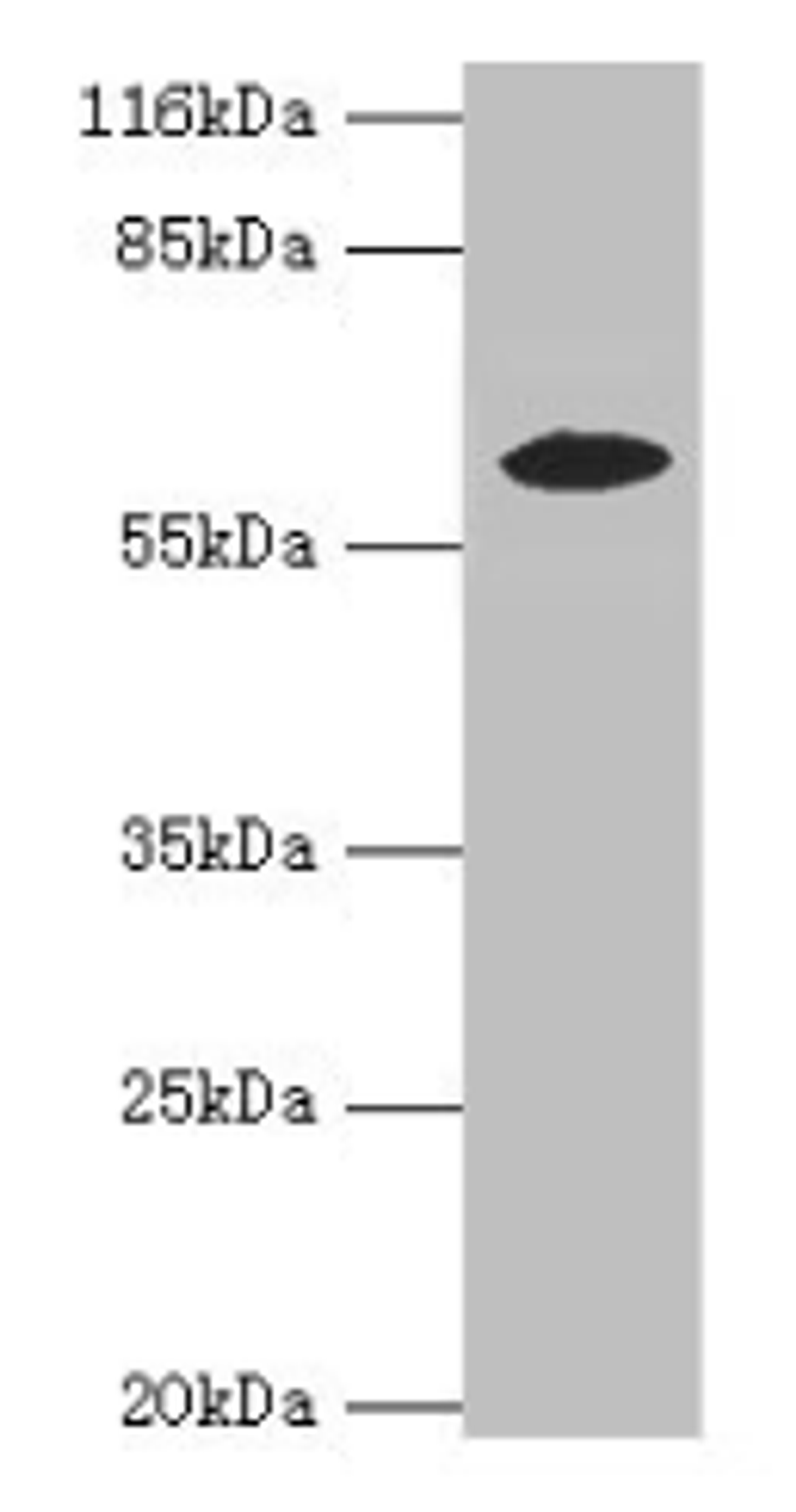 Western blot. All lanes: EPHX2 antibody at 2µg/ml + MCF-7 whole cell lysate. Secondary. Goat polyclonal to rabbit IgG at 1/10000 dilution. Predicted band size: 63, 58, 56 kDa. Observed band size: 58 kDa
