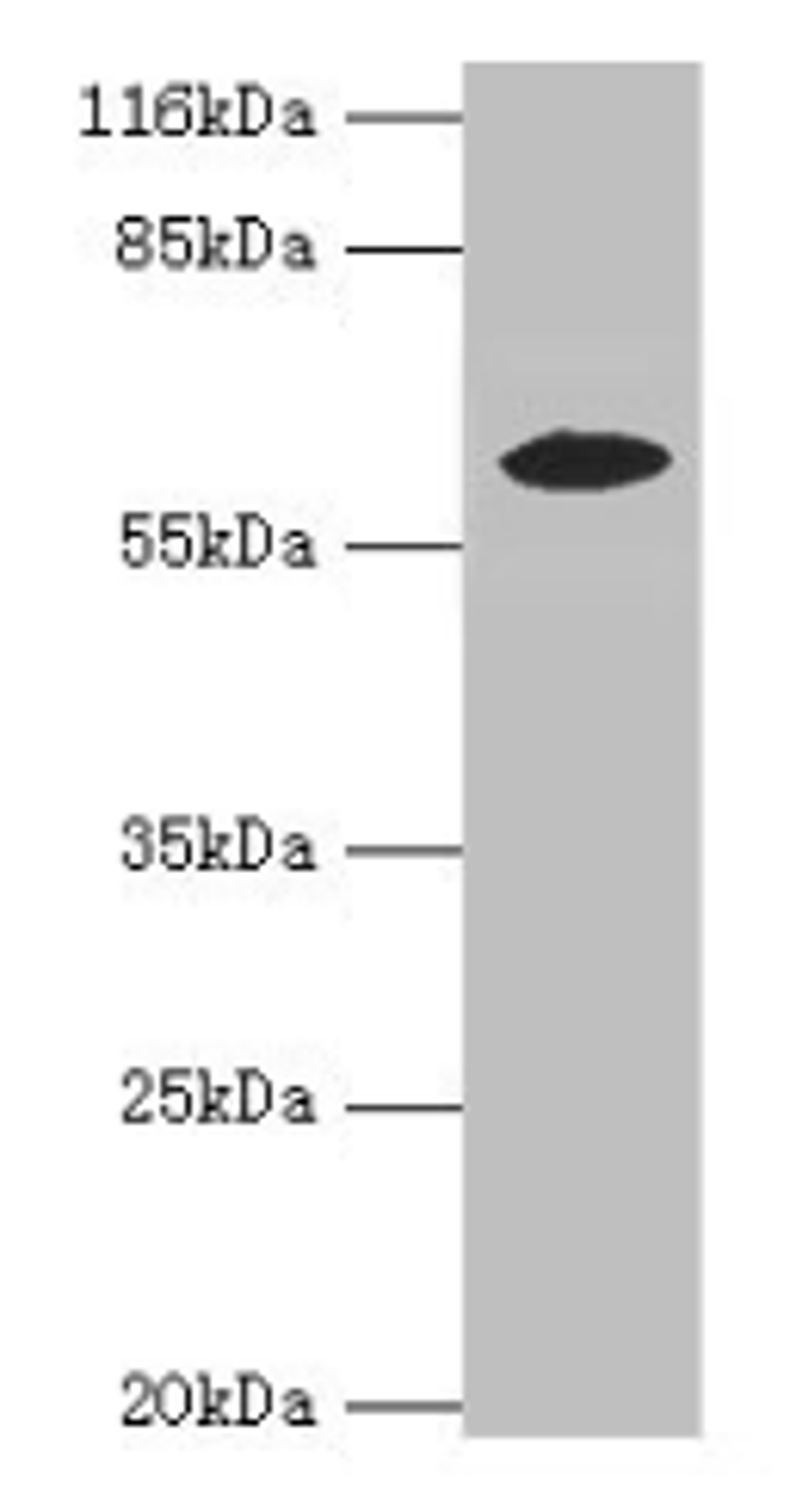 Western blot. All lanes: EPHX2 antibody at 2µg/ml + MCF-7 whole cell lysate. Secondary. Goat polyclonal to rabbit IgG at 1/10000 dilution. Predicted band size: 63, 58, 56 kDa. Observed band size: 58 kDa