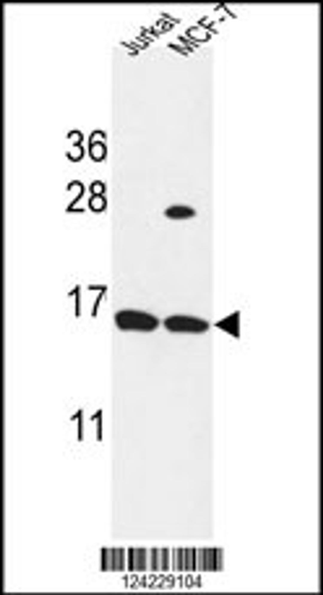 Western blot analysis in Jurkat,MCF-7 cell line lysates (35ug/lane).