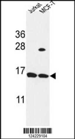 Western blot analysis in Jurkat,MCF-7 cell line lysates (35ug/lane).