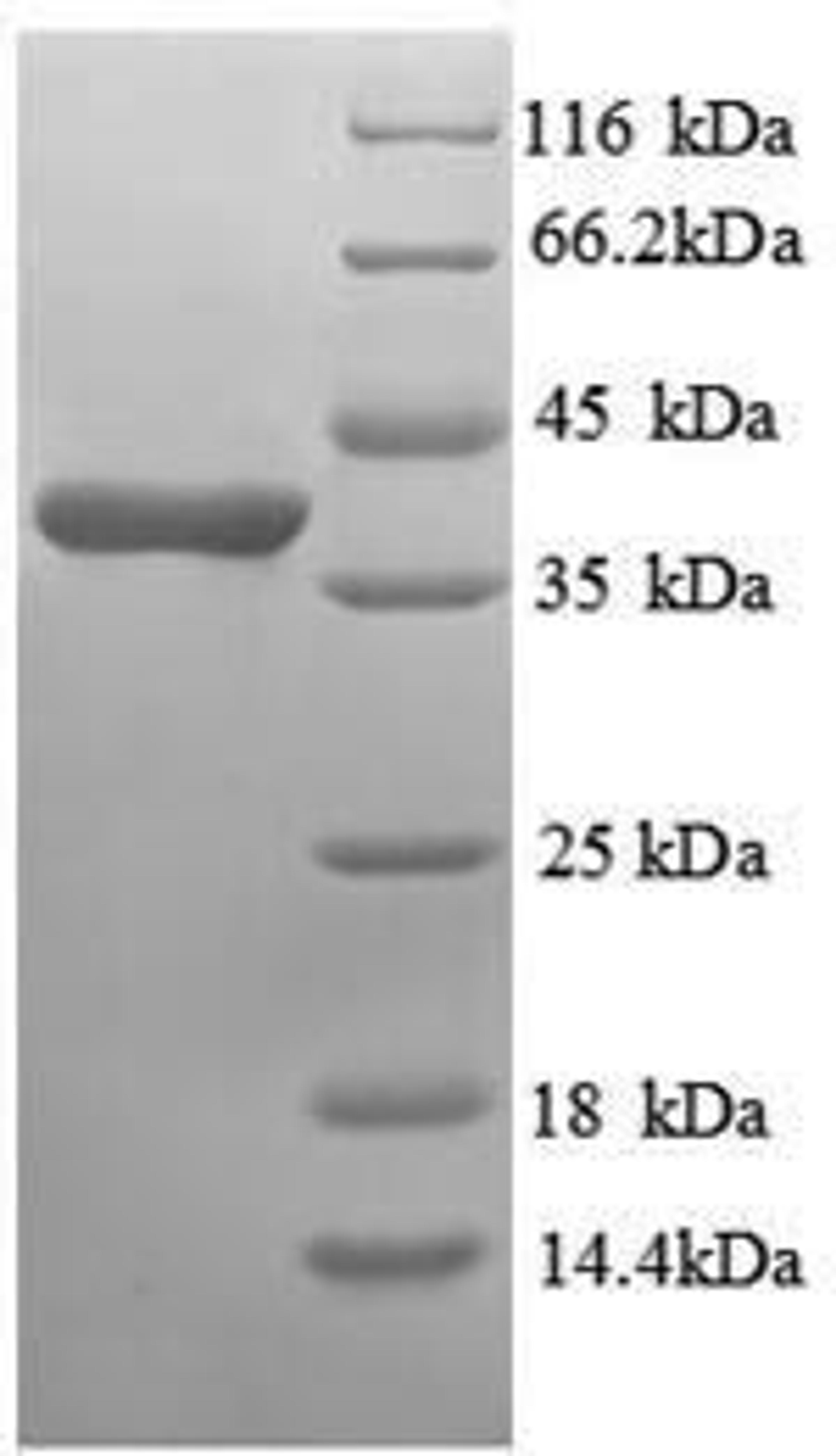 (Tris-Glycine gel) Discontinuous SDS-PAGE (reduced) with 5% enrichment gel and 15% separation gel.