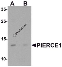 Western blot analysis of PIERCE1 in A20 cell lysate with PIERCE1 antibody at 1 &#956;g/mL in (A) the absence and (B) the presence of blocking peptide.