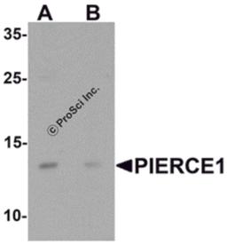 Western blot analysis of PIERCE1 in A20 cell lysate with PIERCE1 antibody at 1 μg/mL in (A) the absence and (B) the presence of blocking peptide.