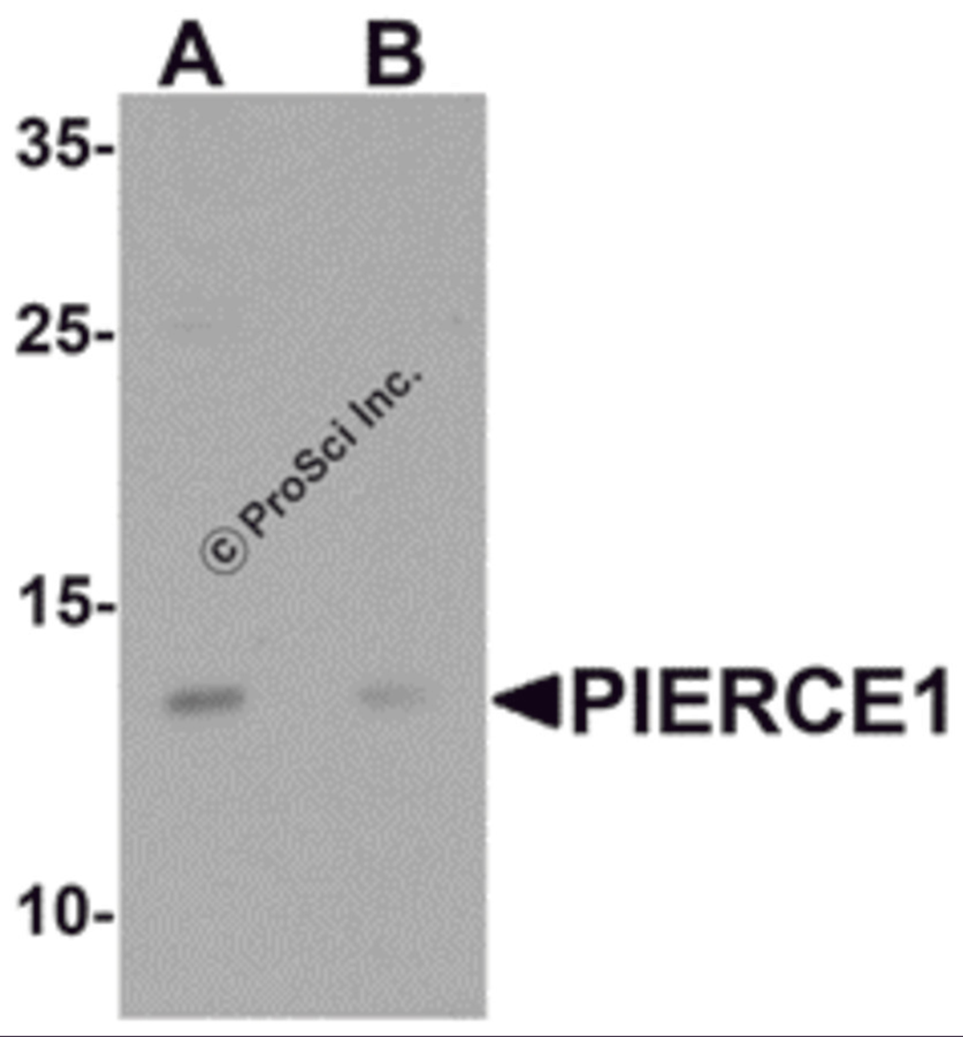 Western blot analysis of PIERCE1 in A20 cell lysate with PIERCE1 antibody at 1 μg/mL in (A) the absence and (B) the presence of blocking peptide.