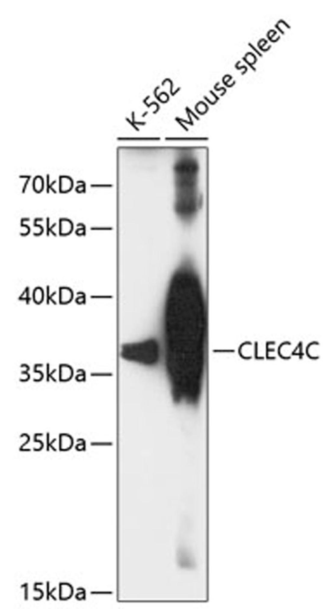 Western blot - CLEC4C antibody (A13702)