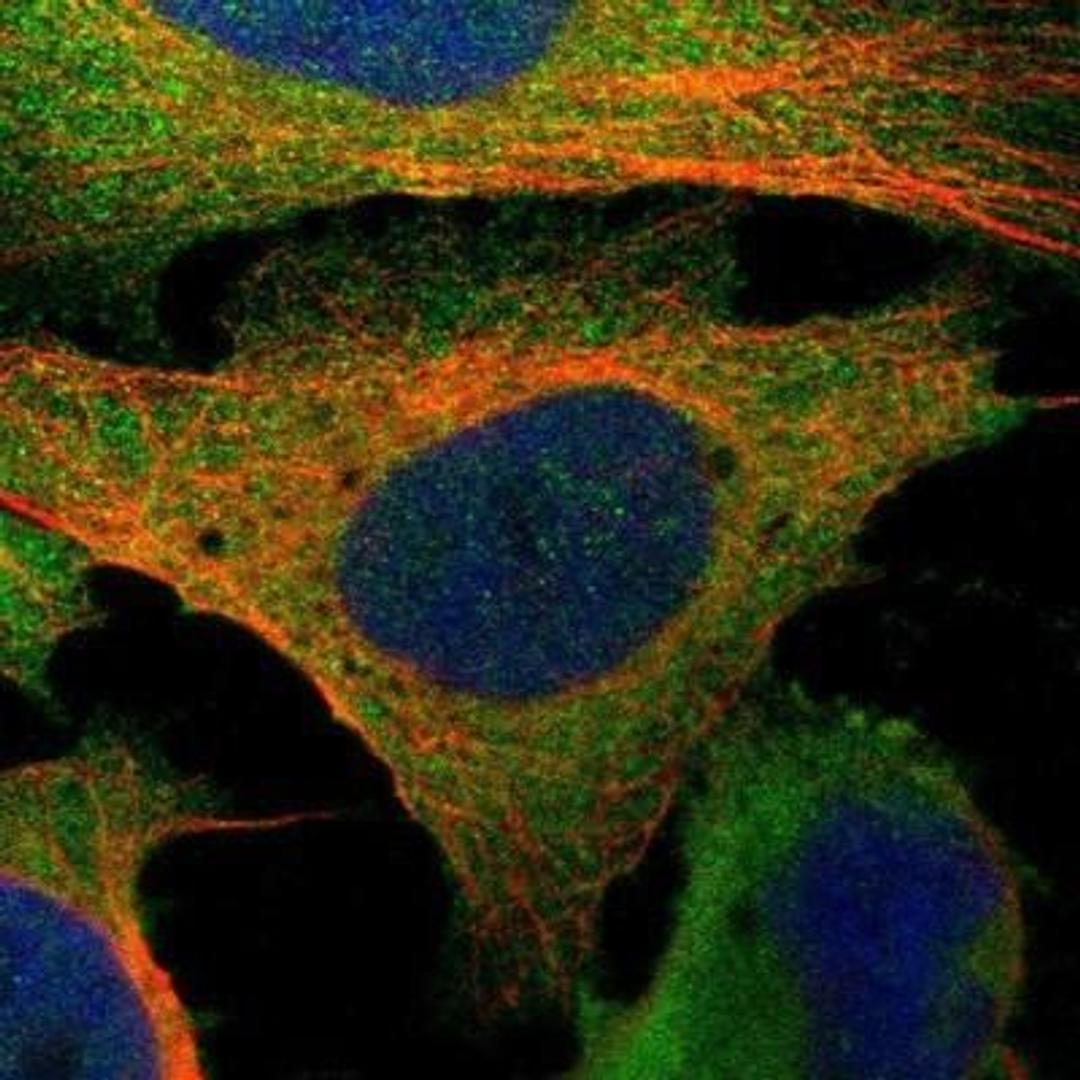 Immunocytochemistry/Immunofluorescence: 5'-Nucleotidase/CD73 Antibody [NBP1-85740] - Staining of human cell line U-2 OS shows positivity in plasma membrane & cytoplasm.