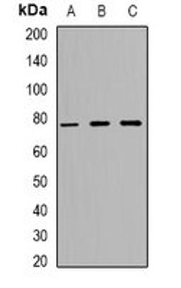 Western blot analysis of HeLa (Lane1), H9C2 (Lane2), NIH3T3 (Lane3) whole cell lysates using ZNF7 antibody